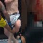 VIDEO: Len pre silné žalúdky! UFC zápasník rozstrieľal súperovu nohu, krv tiekla potokom