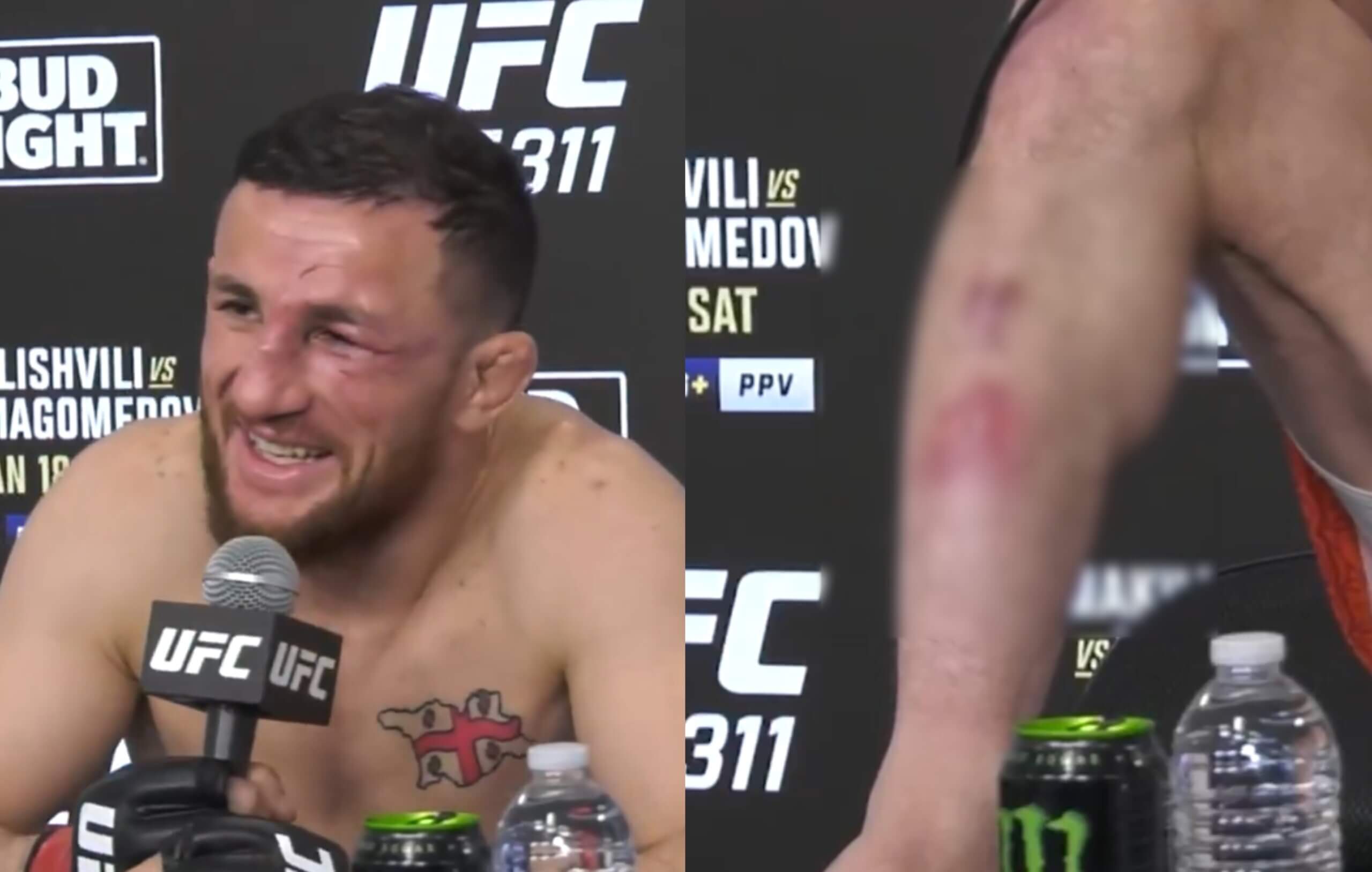 VIDEO Riskoval všetko: Ako šampión UFC oklamal komisiu a vyhral s krvavým zranením