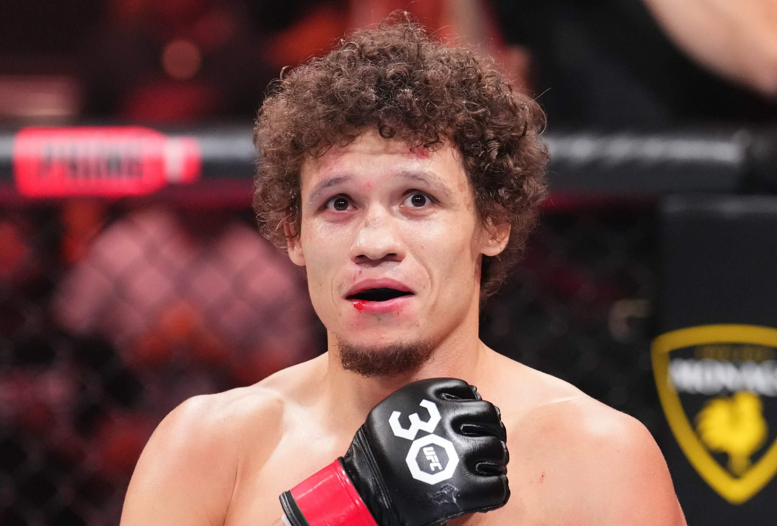 FOTO: Len pre silné povahy! Ruský bojovník odišiel z turnaja UFC s desivým cutom