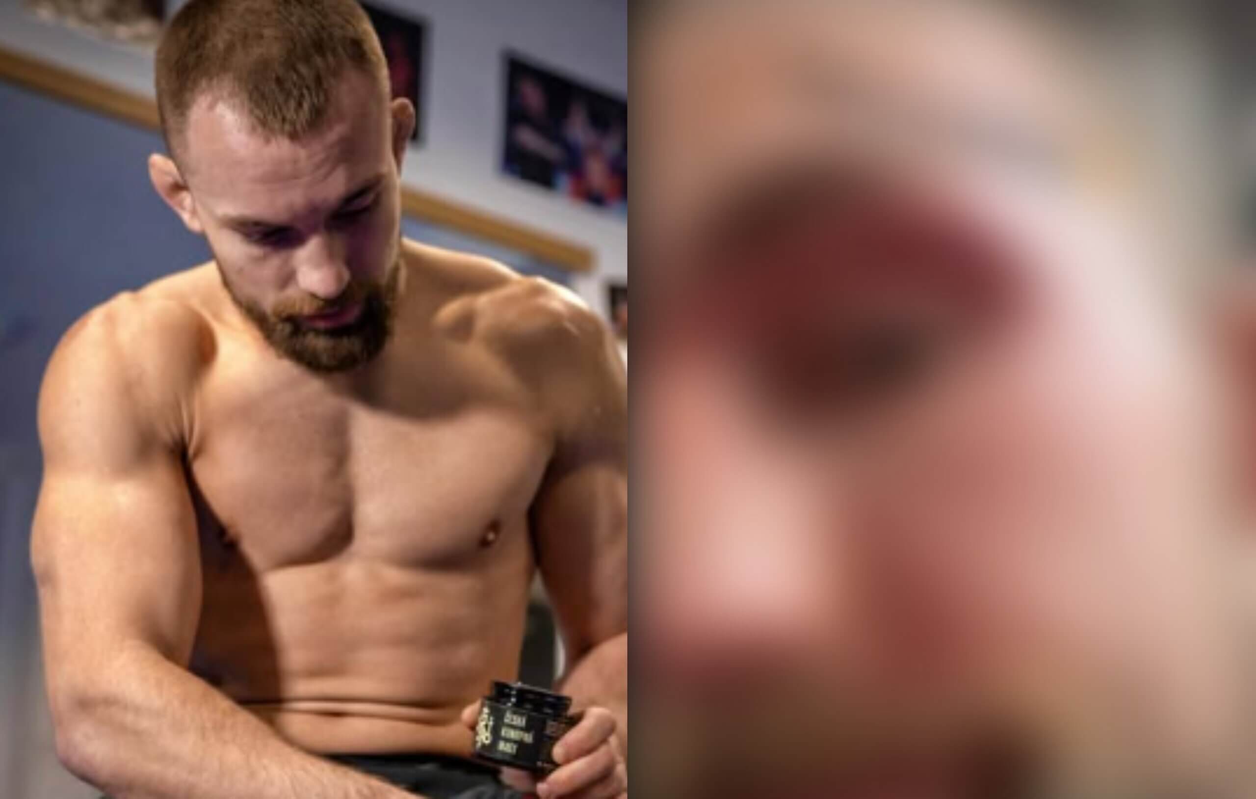 FOTO Au, to muselo bolieť! Lajoš Klein skončil s nepríjemným zranením
